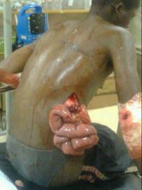 Hubertus Mabel  (Photo via Buktar Tabuni)