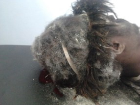 Polisi Tembak Kepala Irwan Wenda