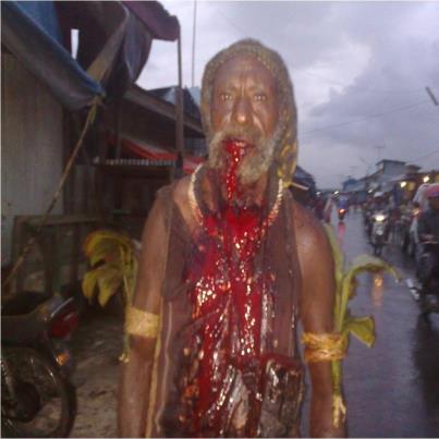 Yulianus Yeimo after his beating  in November 2012 (Photo: WPM sources)