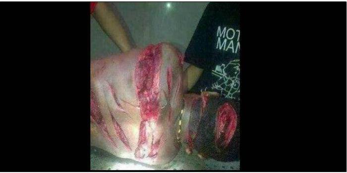 2 Victim Petius Tabuni after being hacked to death by militias in Manado. Photo supplied