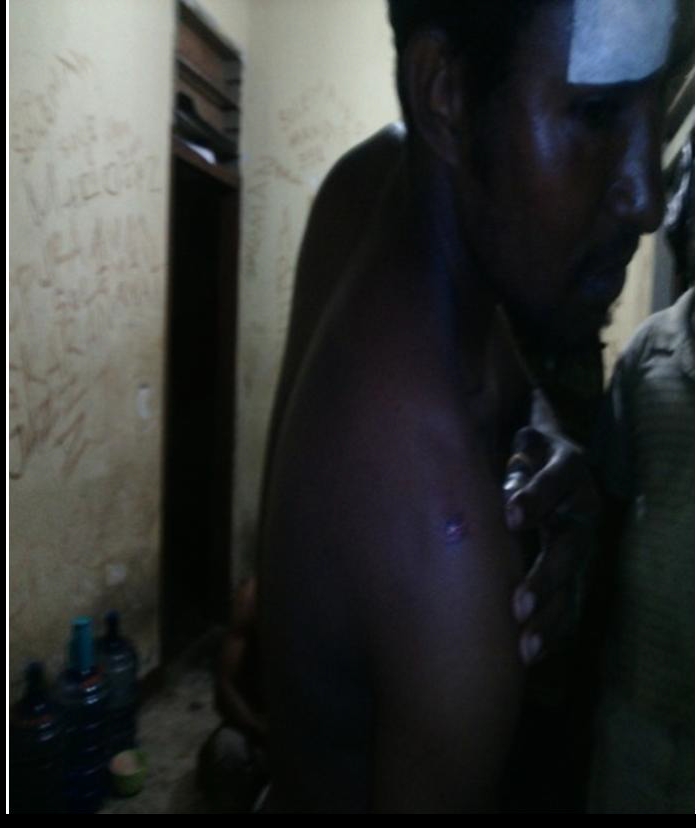 Amsal's body is covered with bruises caused by Airforce military members