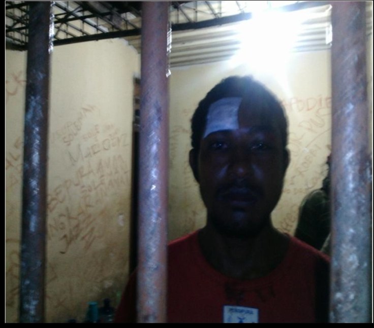 Wound above Amsal Marandof's right eye