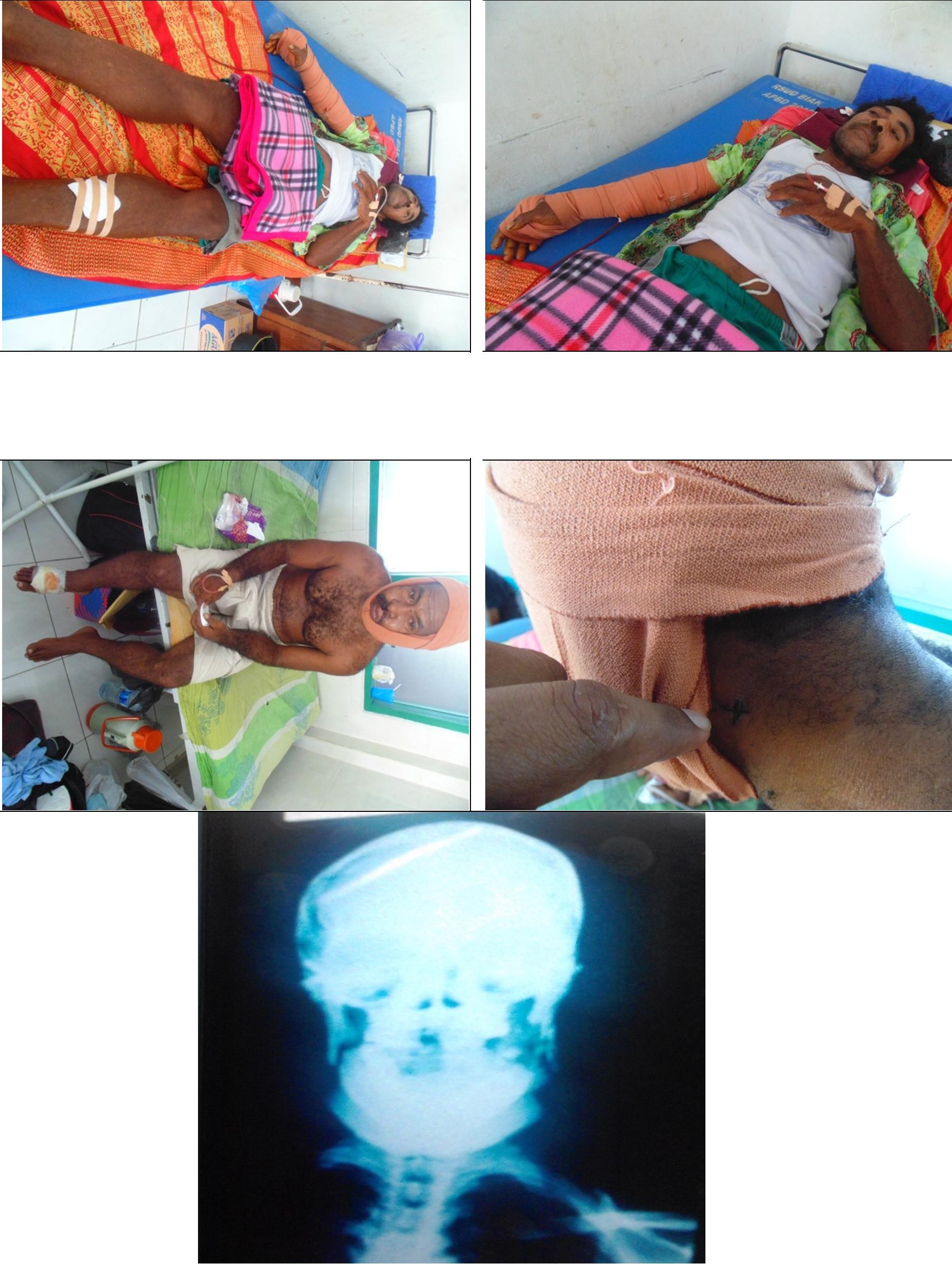 English Desember 1st 2015 4 and 5