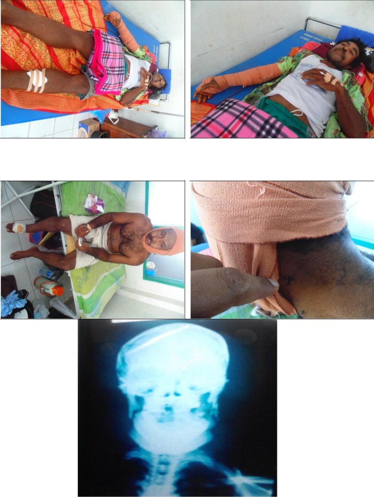 English Desember 1st 2015 4 and 5